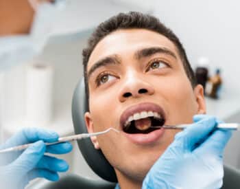 Composite Dental Fillings